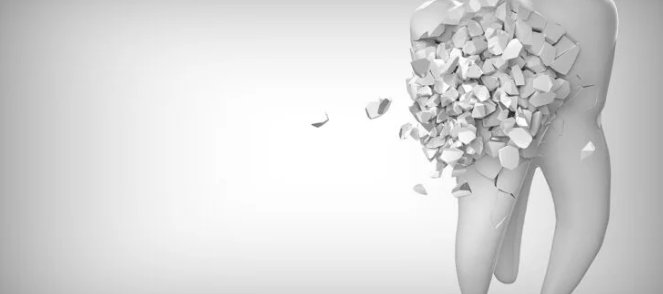 Diente en 3D desmenuzándose en fragmentos sobre fondo gris claro.